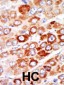 AK1 Antibody (C-term)